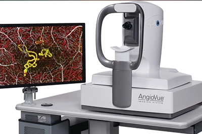 Optical Coherence Tomography